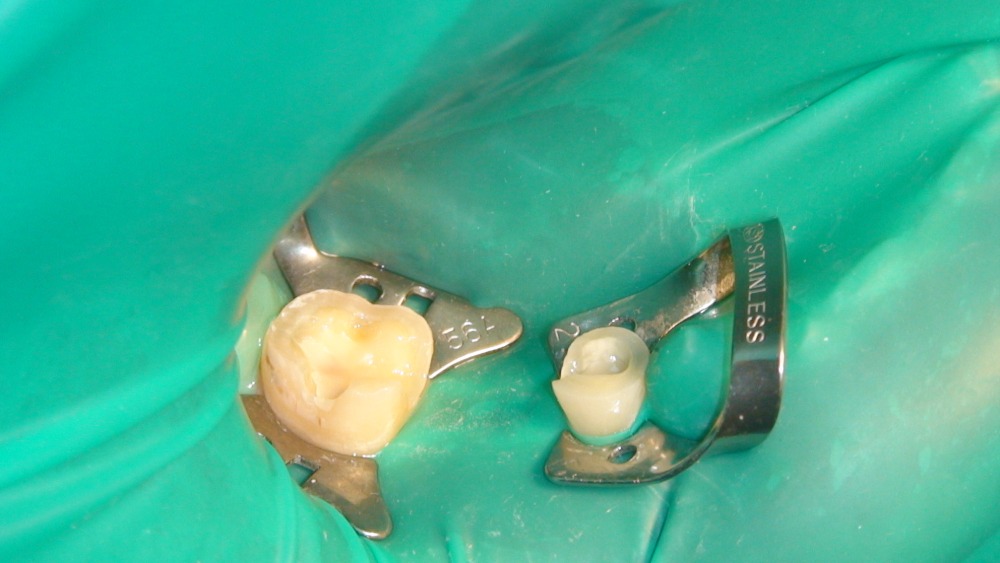 Лечение зубов в Бийске отзывы